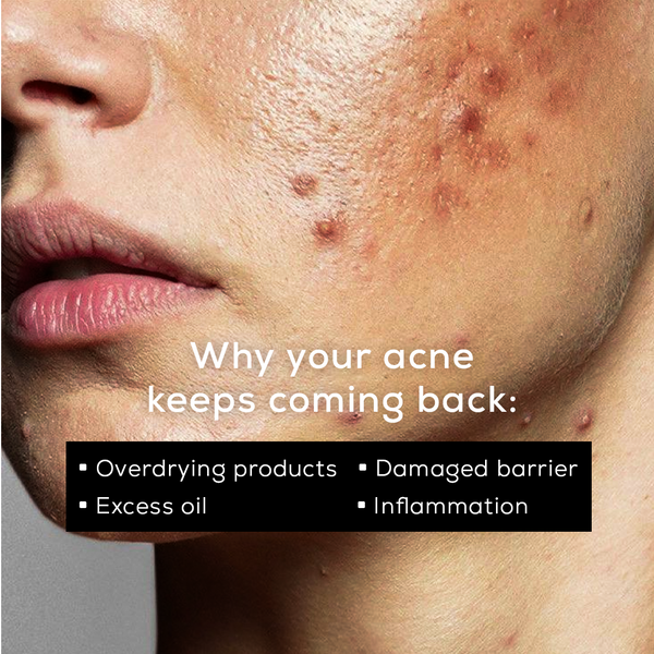 The Barrier Repair Kit