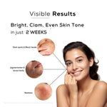 Chamomile, Vitamin C & Alpha Arbutin Glow Serum for Irritation, Redness, Brightening & Dark Spots