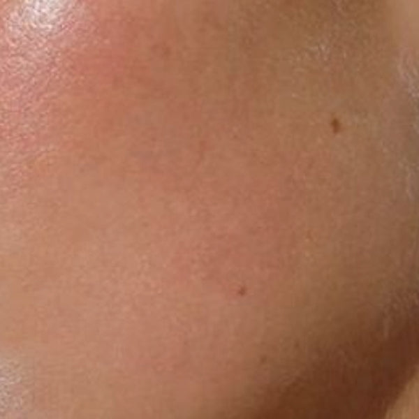 Complete Skin Reset