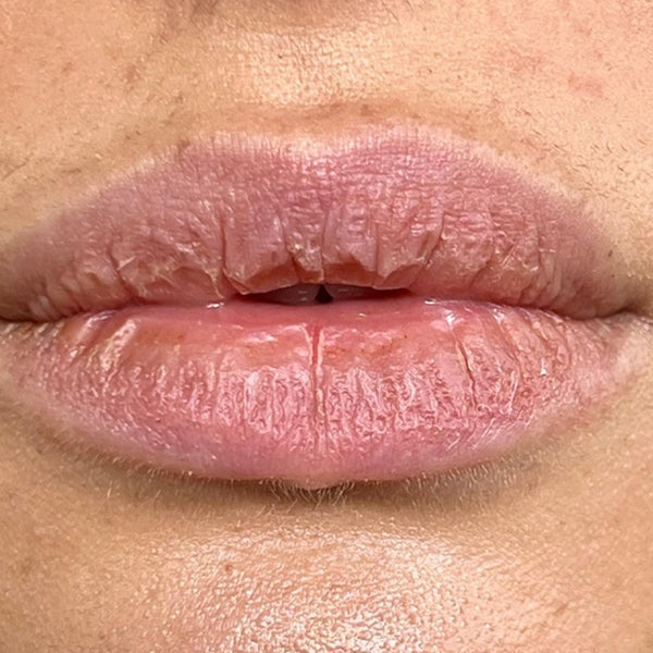 Dry Skin & Lip Care