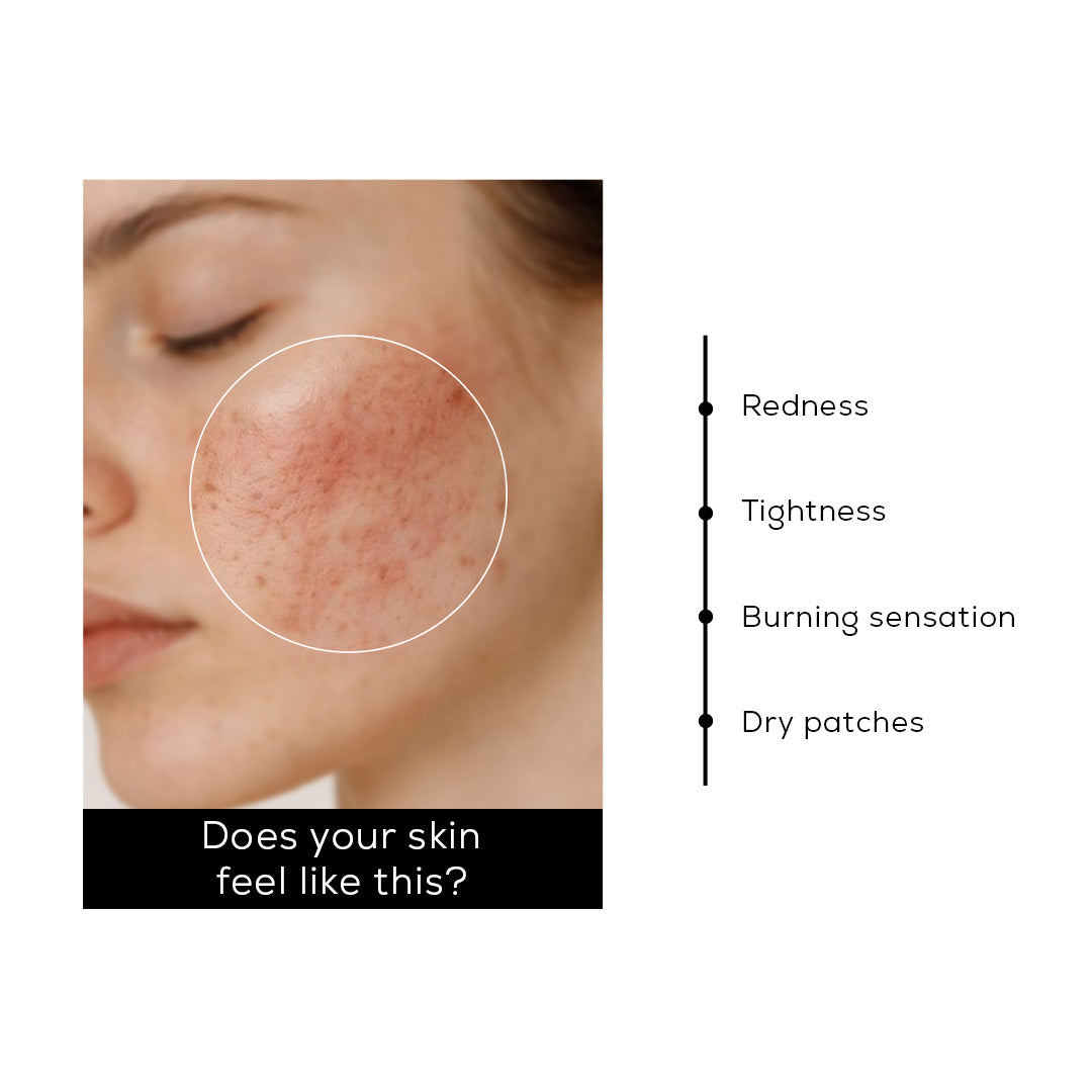 The Sensitive Skin Kit