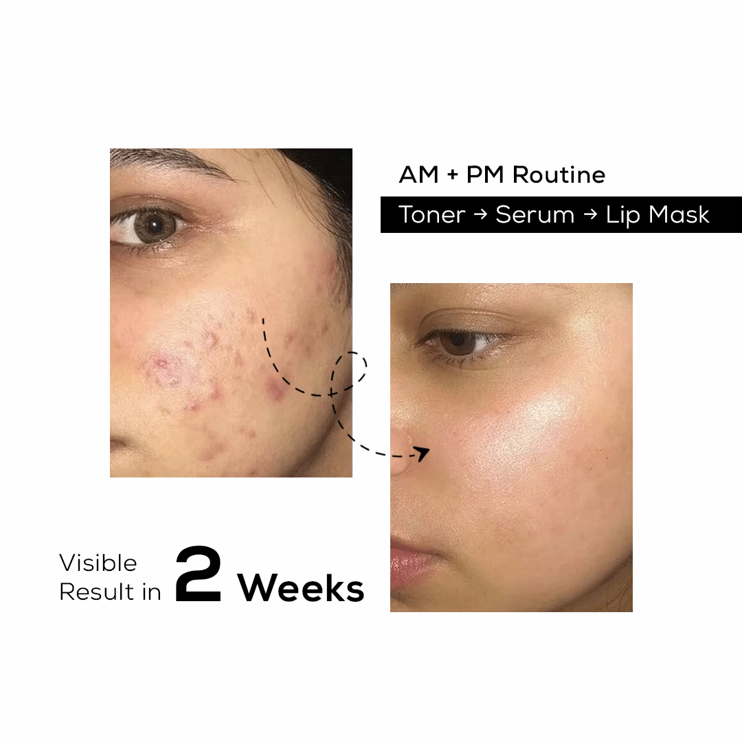 The Sensitive Skin Kit