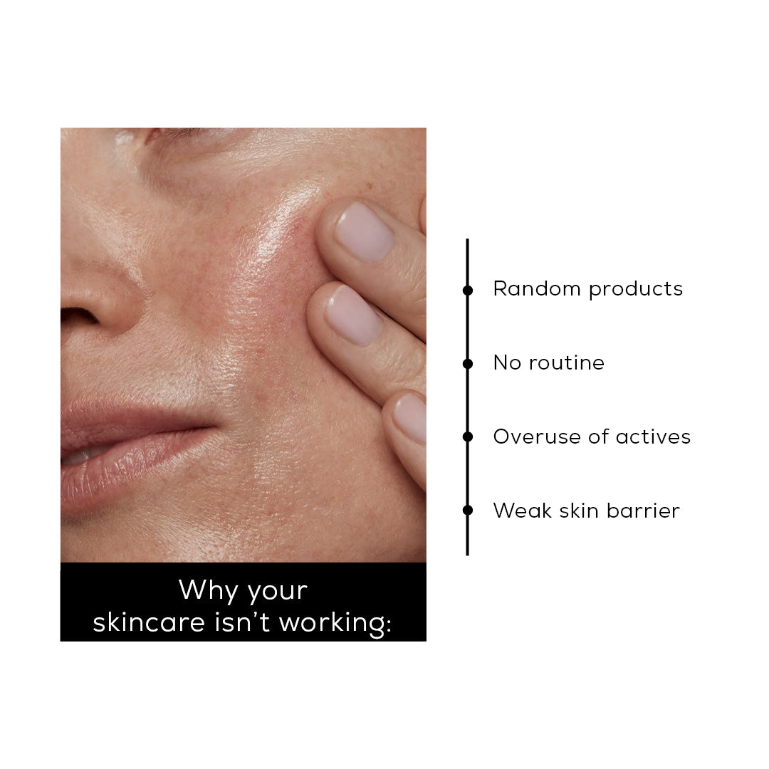 The Skin Reset System