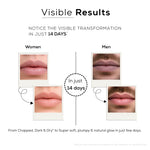 Lip Repair Sleeping Mask for Dry, Dark & Chapped Lips